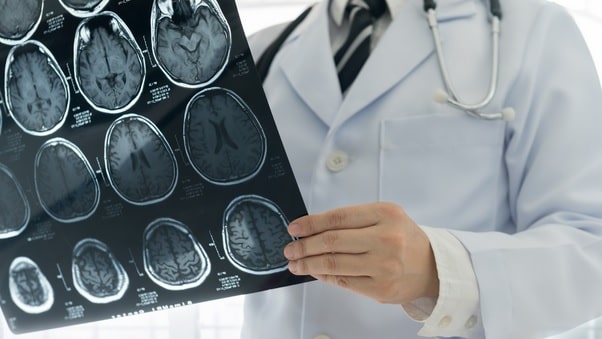 Traumatic Brain Injury - Diagnosis and Treatment