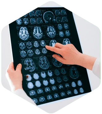 Traumatic Brain Injury